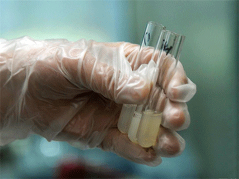 使用供卵做试管需要哪些检查(供卵试管需哪些检查？)