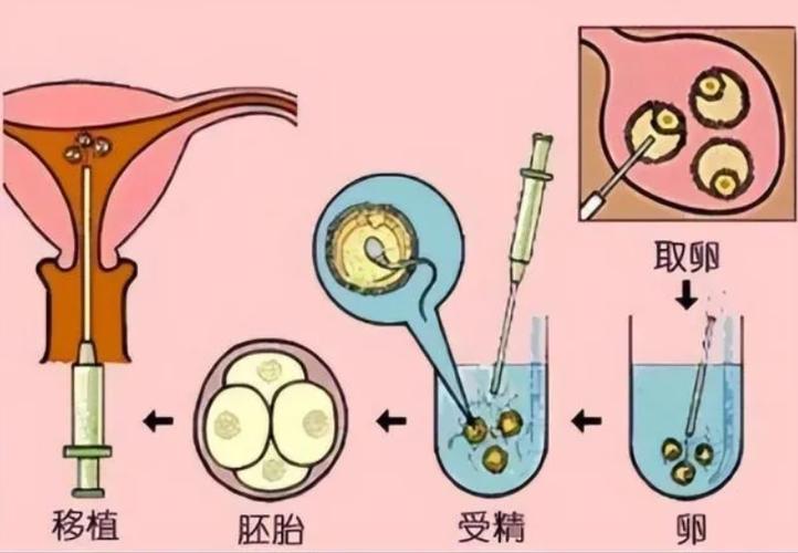 可以供卵借肚子生孩子吗【可以借肚子生孩子吗?提供卵子的可能性】