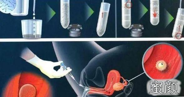 哪里可以做供卵试管婴儿-哪里可以进行供卵试管婴儿手术？