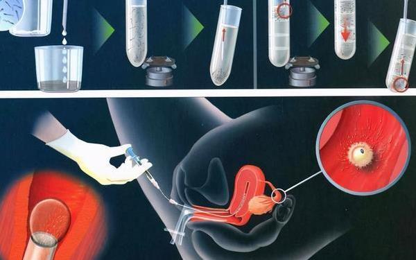国内哪里可以做供卵试管_国内哪里可以做供卵试管?